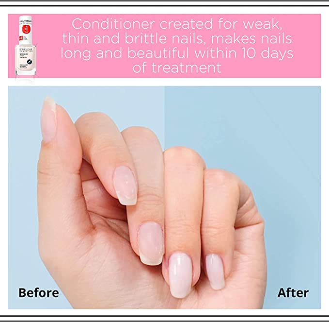 Brittle Nails: Causes and Treatment Tips